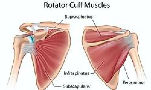Rotator Cuff Repair